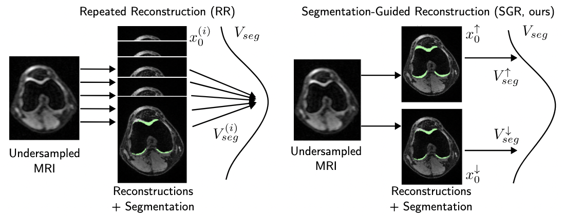 Segmentation-Guided MRI Reconstruction for Meaningfully Diverse Reconstructions